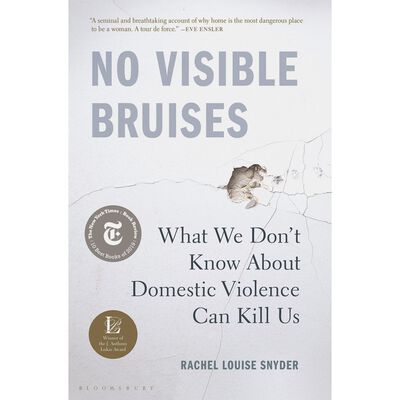NO VISIBLE BRUISES